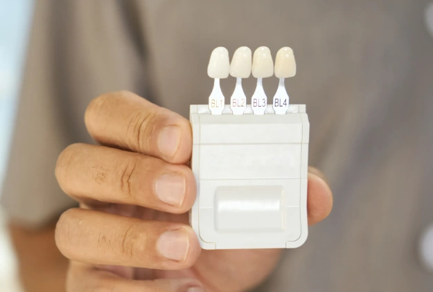 Who is a Good Candidate for Veneers?